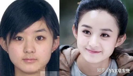那些整容的明星网红,揭秘美丽背后的秘密与争议